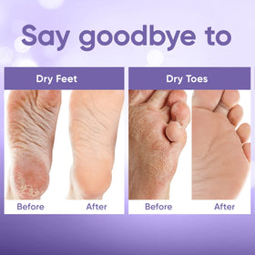 CÉLOR Foot Peeling Mask applied on feet with lavender background