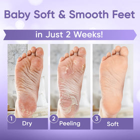 CÉLOR Foot Peeling Mask booties laid out for use