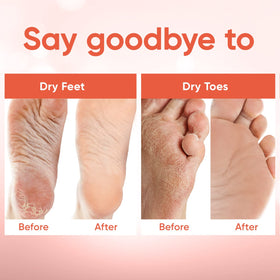 CÉLOR Foot Peeling Mask in use with feet inside booties