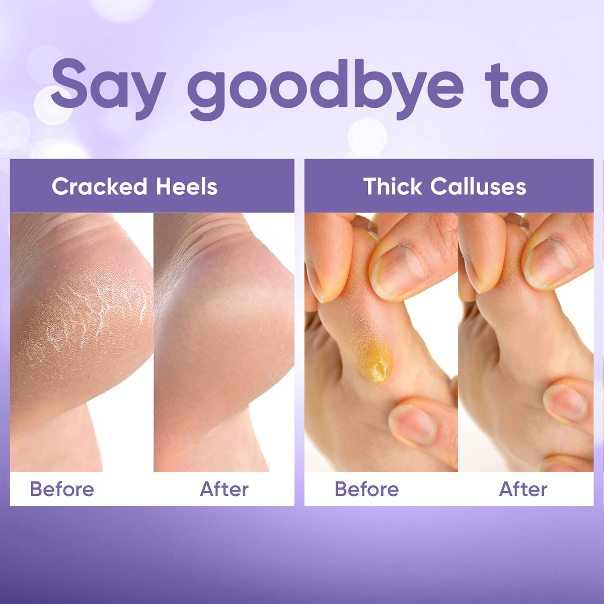 CÉLOR Foot Peeling Mask in use with relaxing spa setting
