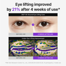 CENTELLIAN 24 360º Shot PDRN Eye Cream application on skin