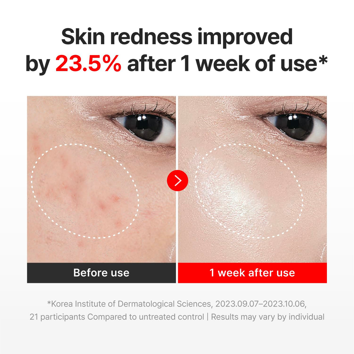 CENTELLIAN 24 Madeca Cream Time Reverse on a skincare shelf