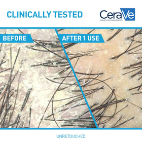 CeraVe 2 In 1 Hydrating Anti Dandruff Shampoo and Conditioner side view