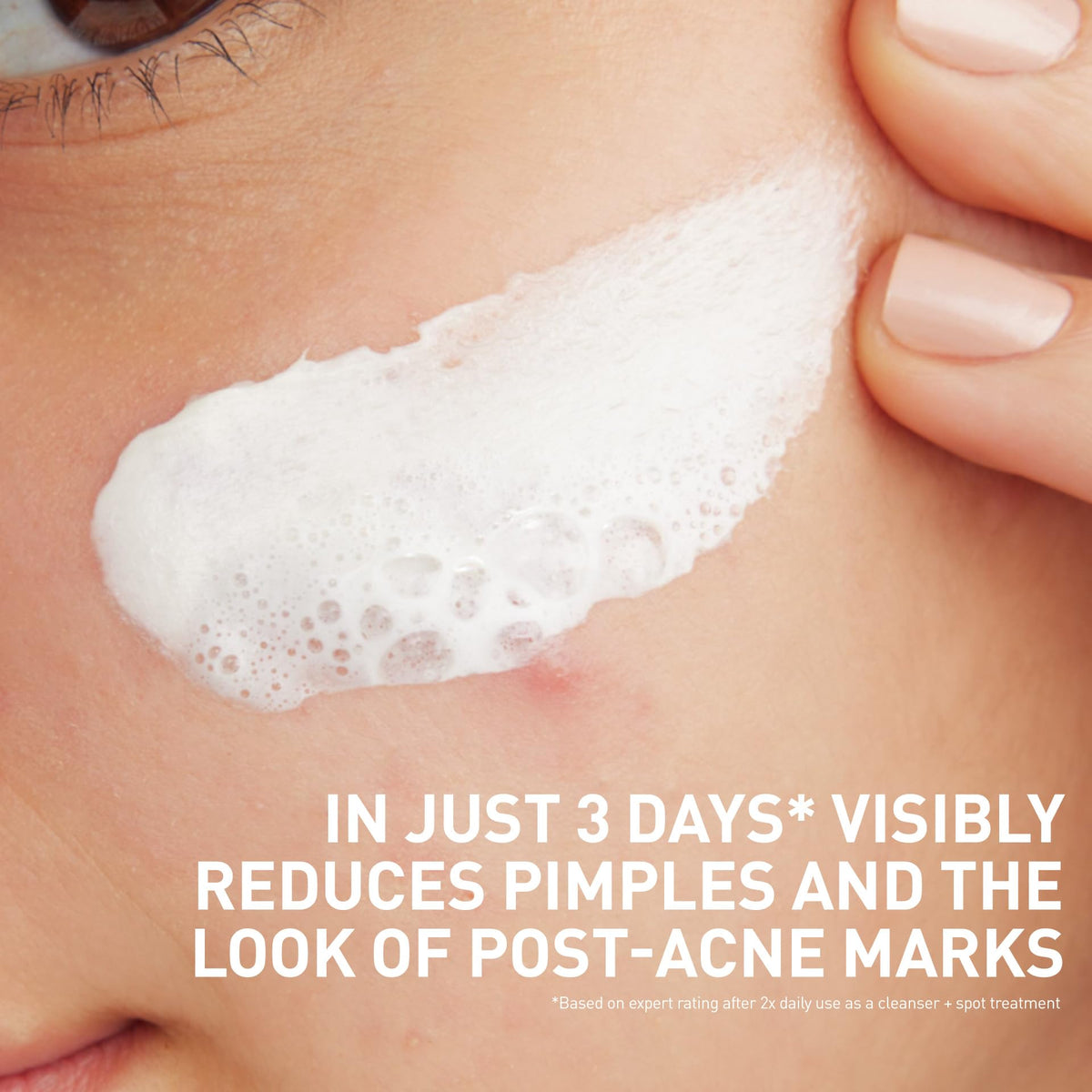 CeraVe Acne Cleanser texture close-up