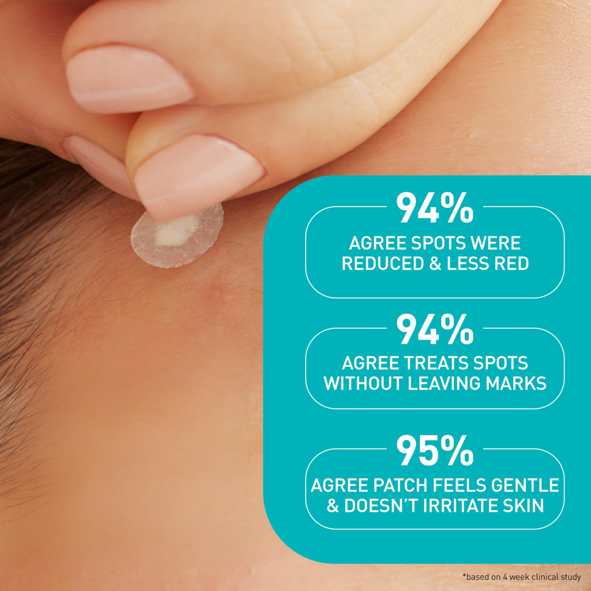 CeraVe Blemish Patches in a hand with clear skin