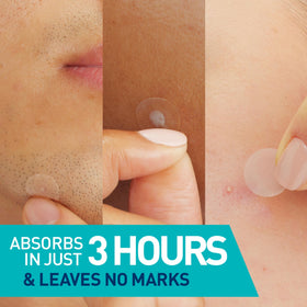 CeraVe Blemish Patches showing packaging and contents