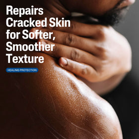 Cetaphil Cracked Skin Repair Lotion 16 oz side view