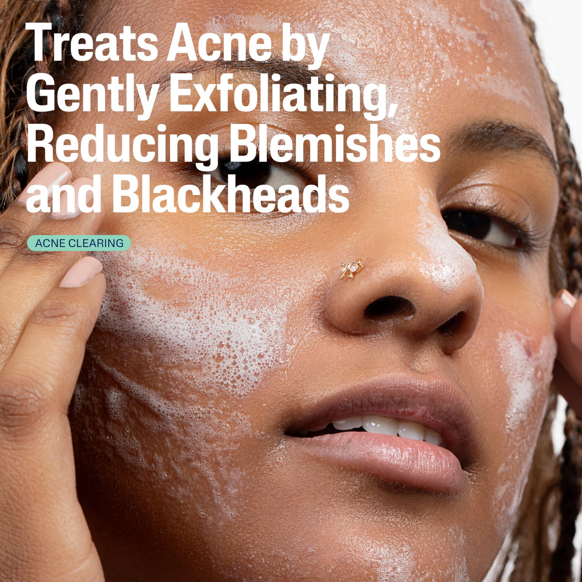 Cetaphil Gentle Clear Acne Foaming Face Wash in bathroom setting