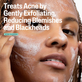 Cetaphil Gentle Clear Acne Foaming Face Wash in bathroom setting