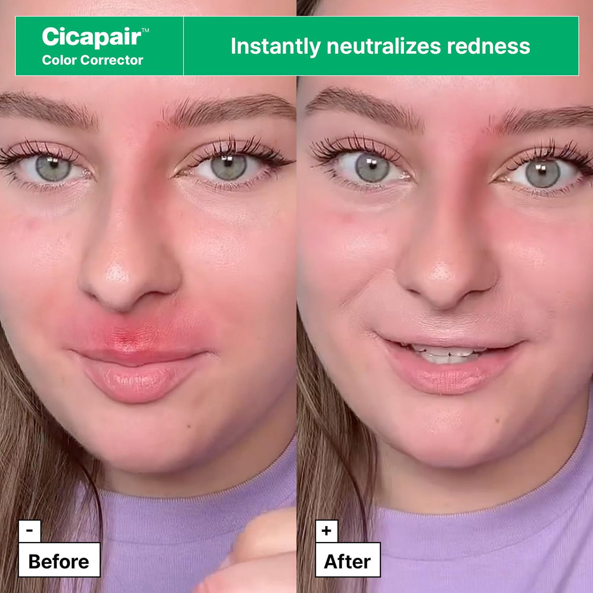 Cicapair Sensitive Skin Moisturizer for Redness jar