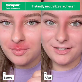 Cicapair Sensitive Skin Moisturizer for Redness jar