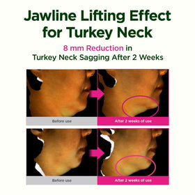 CKD Guaranteed Neck Cream application demonstration
