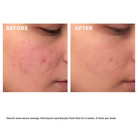 CLARINS Beauty Flash Peel in lifestyle setting