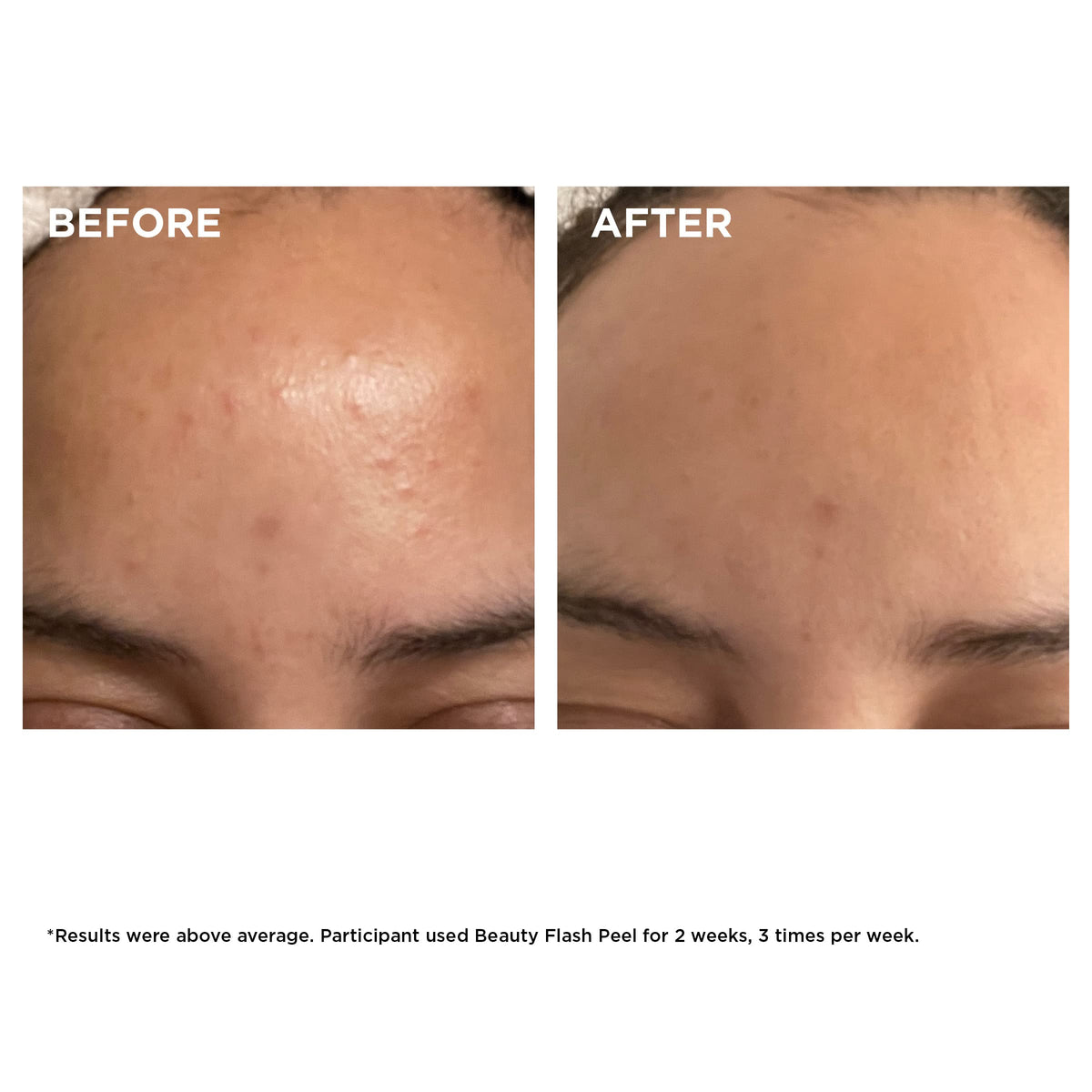 CLARINS Beauty Flash Peel texture close-up