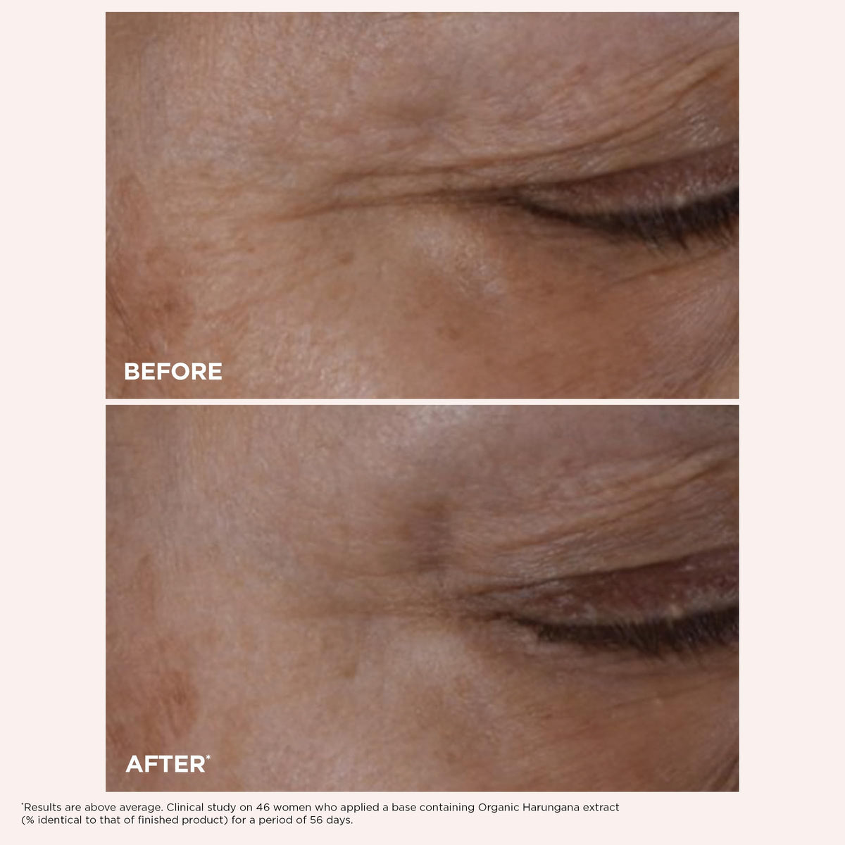 CLARINS Total Eye Lift with packaging details