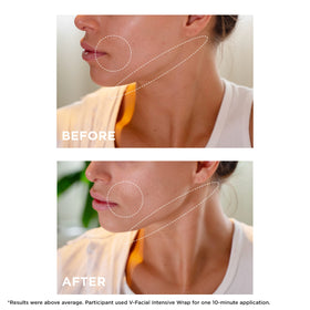 CLARINS V-Facial Intensive Wrap Face Mask application on skin
