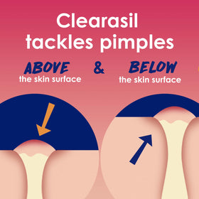 Clearasil Rapid Rescue Acne Face Pads with 2% Salicylic Acid close-up