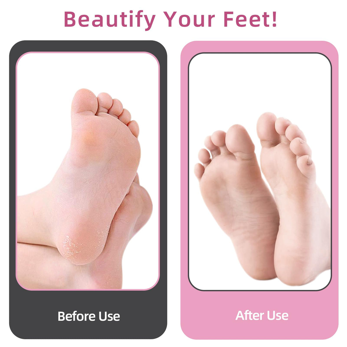 Close-up of APRELM Electric Foot Callus Remover showing speed control