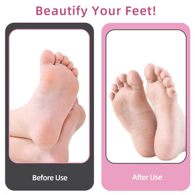 Close-up of APRELM Electric Foot Callus Remover showing speed control