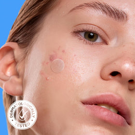 Close-up of AVARELLE Hydrocolloid Pimple Patch