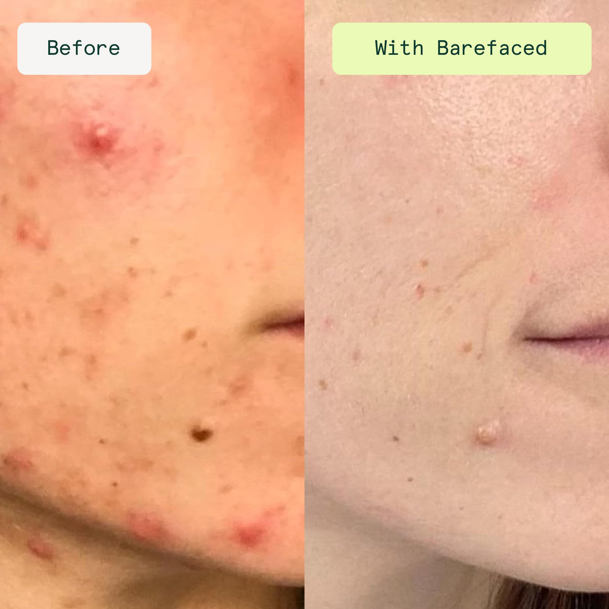 Close-up of Barefaced Toning Pads II packaging