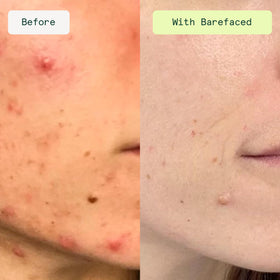 Close-up of Barefaced Toning Pads II packaging