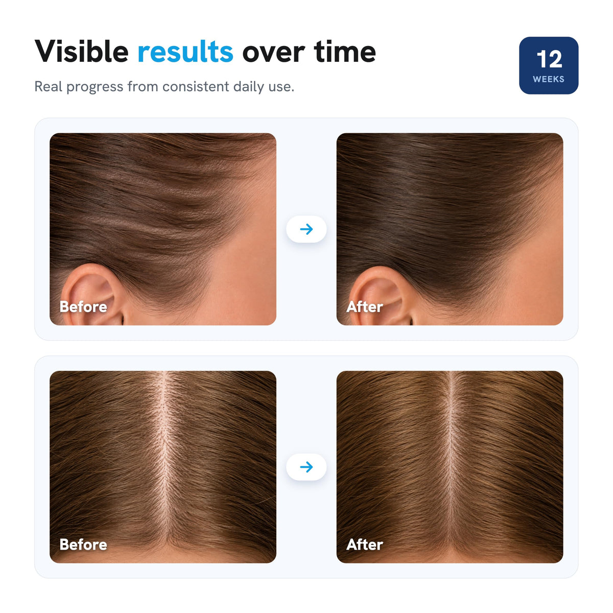 Close-up of Be Bodywise Hair Density Roll-On Serum ingredients