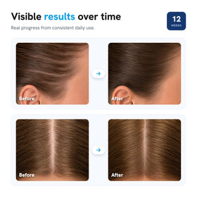 Close-up of Be Bodywise Hair Density Roll-On Serum ingredients