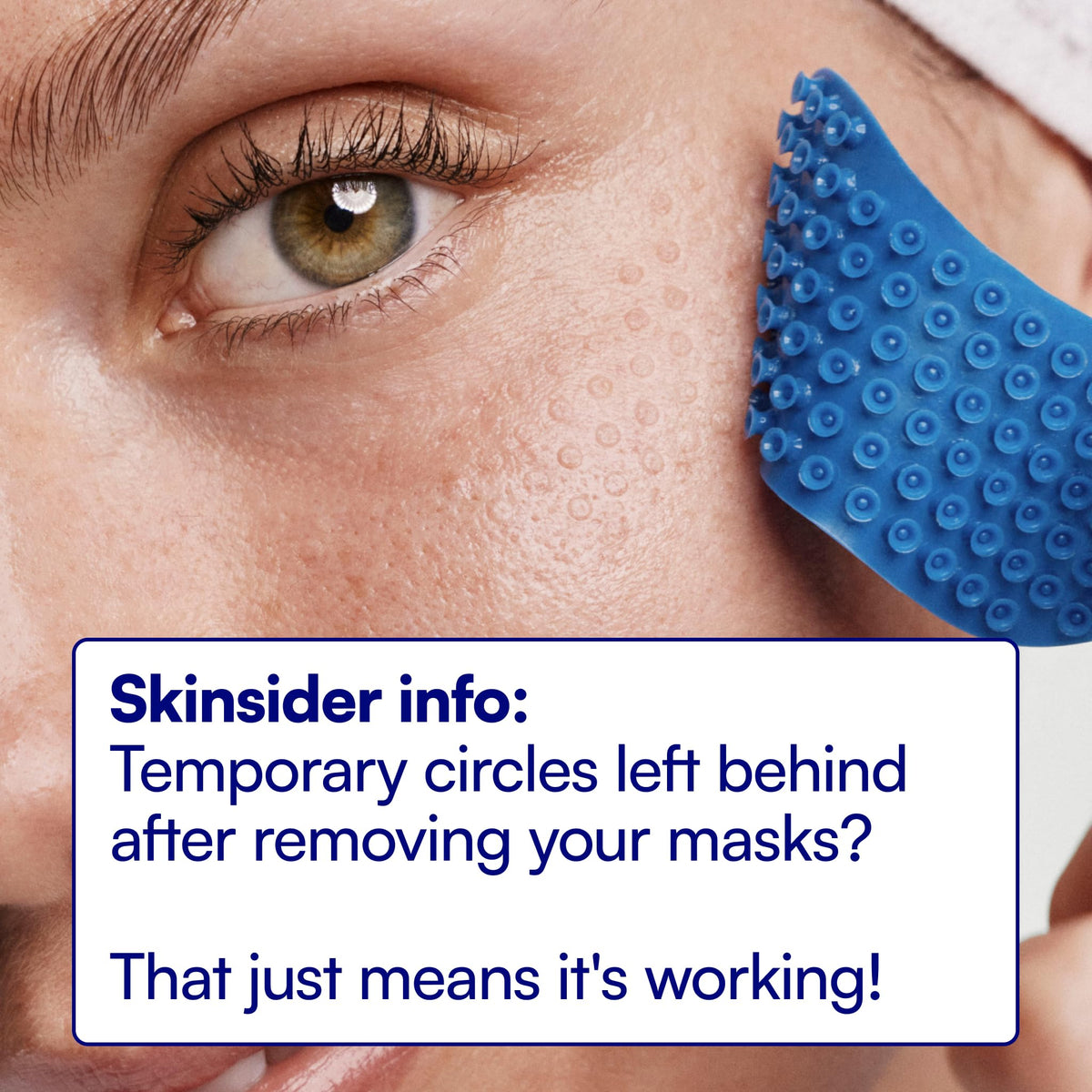 Close-up of Bliss Pro Under-Eye Masks suction design