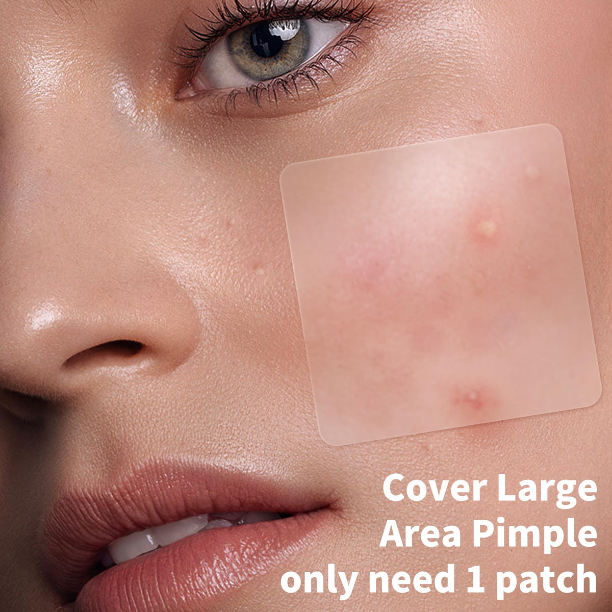 Close-up of Daolyo Large Pimple Patch on skin