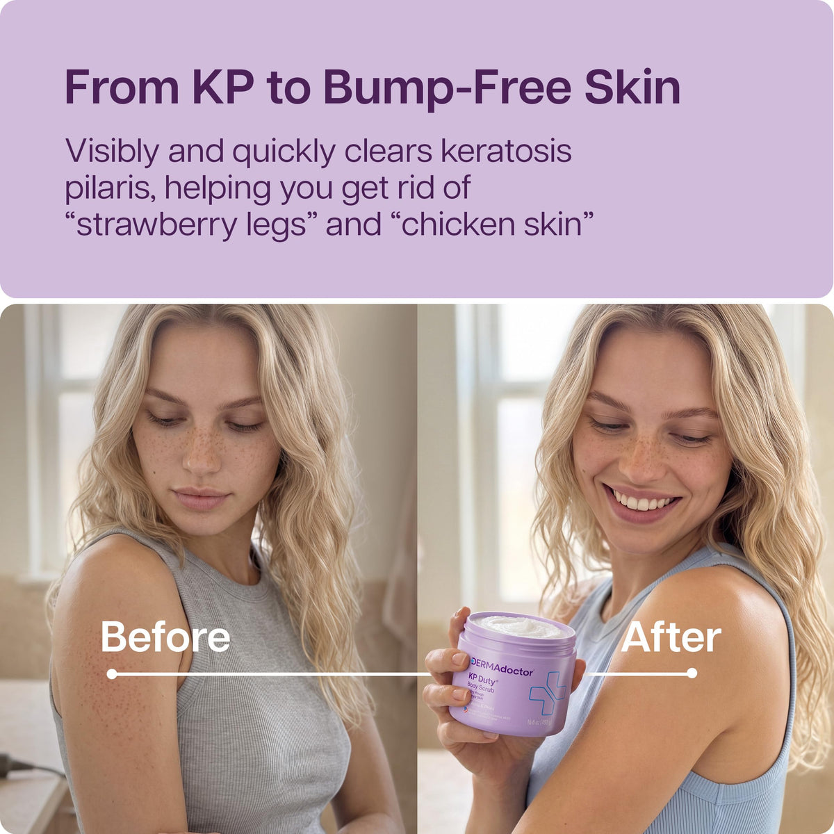 Close-up of DERMAdoctor KP Bump Eraser Body Scrub texture