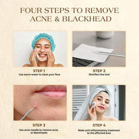 Close-up of DERMATED blackhead remover tool with dual-ended design
