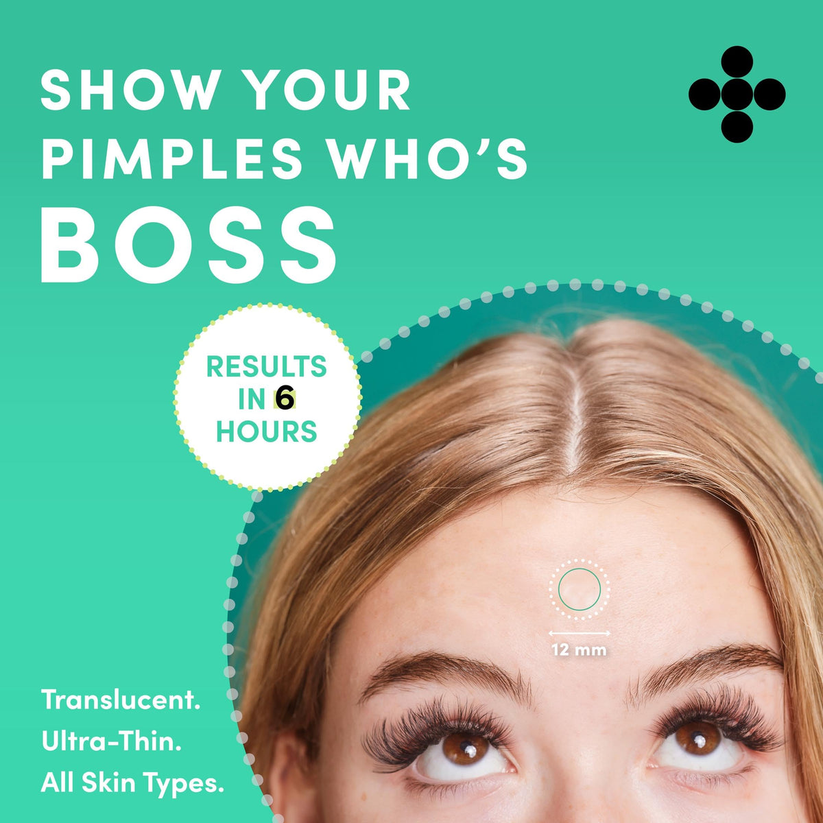Close-up of Dots for Spots Acne Pimple Patch on skin