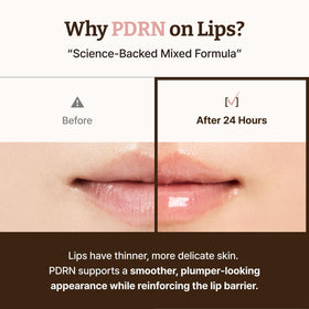 Close-up of Dr.Reju-All PDRN serum applicator tip