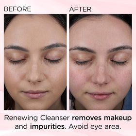 Close-up of Elizabeth Arden Ceramide Skin Renewing Facial Cleanser texture