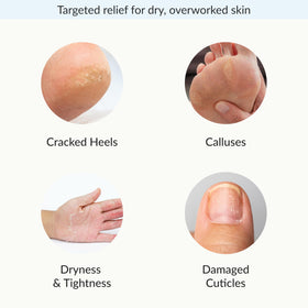 Close-up of Epielle hand and foot masks showing texture