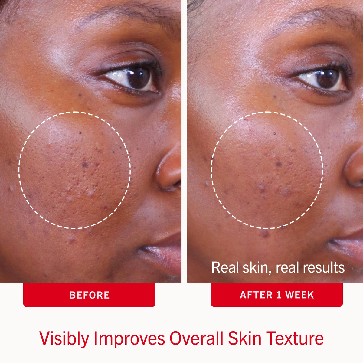Close-up of First Aid Beauty Acne Pads texture