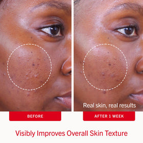 Close-up of First Aid Beauty Acne Pads texture