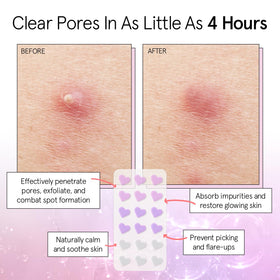 close-up of grace & stella hydrocolloid patches applied on skin