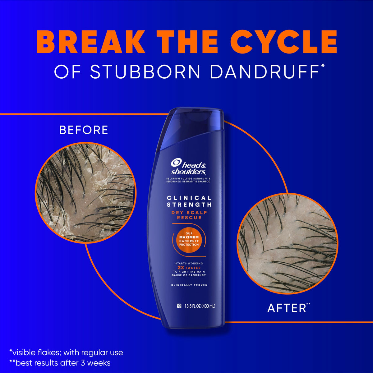 Close-up of Head & Shoulders Shampoo texture on hand