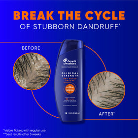 Close-up of Head & Shoulders Shampoo texture on hand