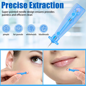 Close-up of HFYHWT sterile lancets for blemish removal