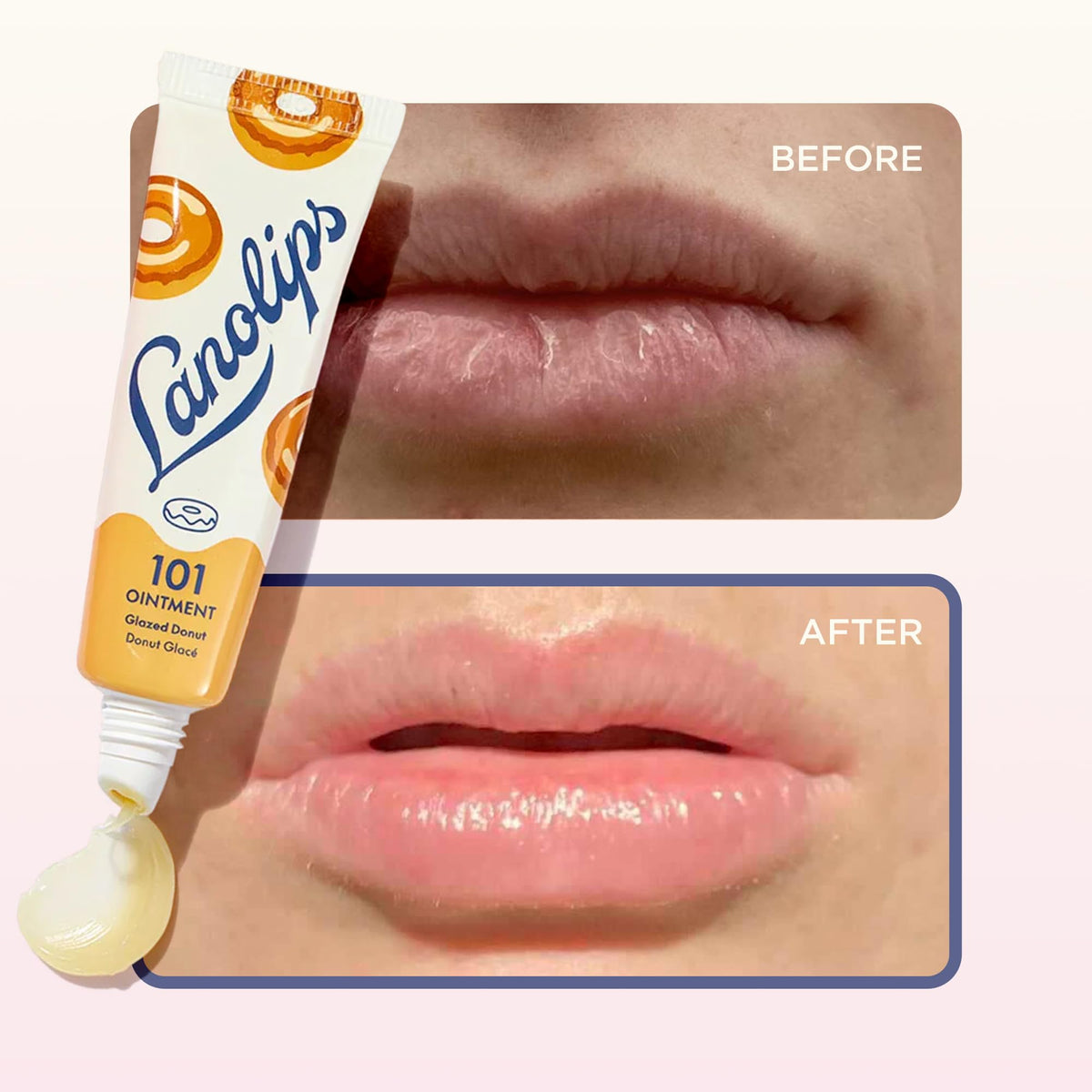 Close-up of Lanolips 101 Ointment texture