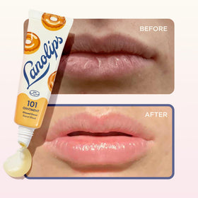Close-up of Lanolips 101 Ointment texture