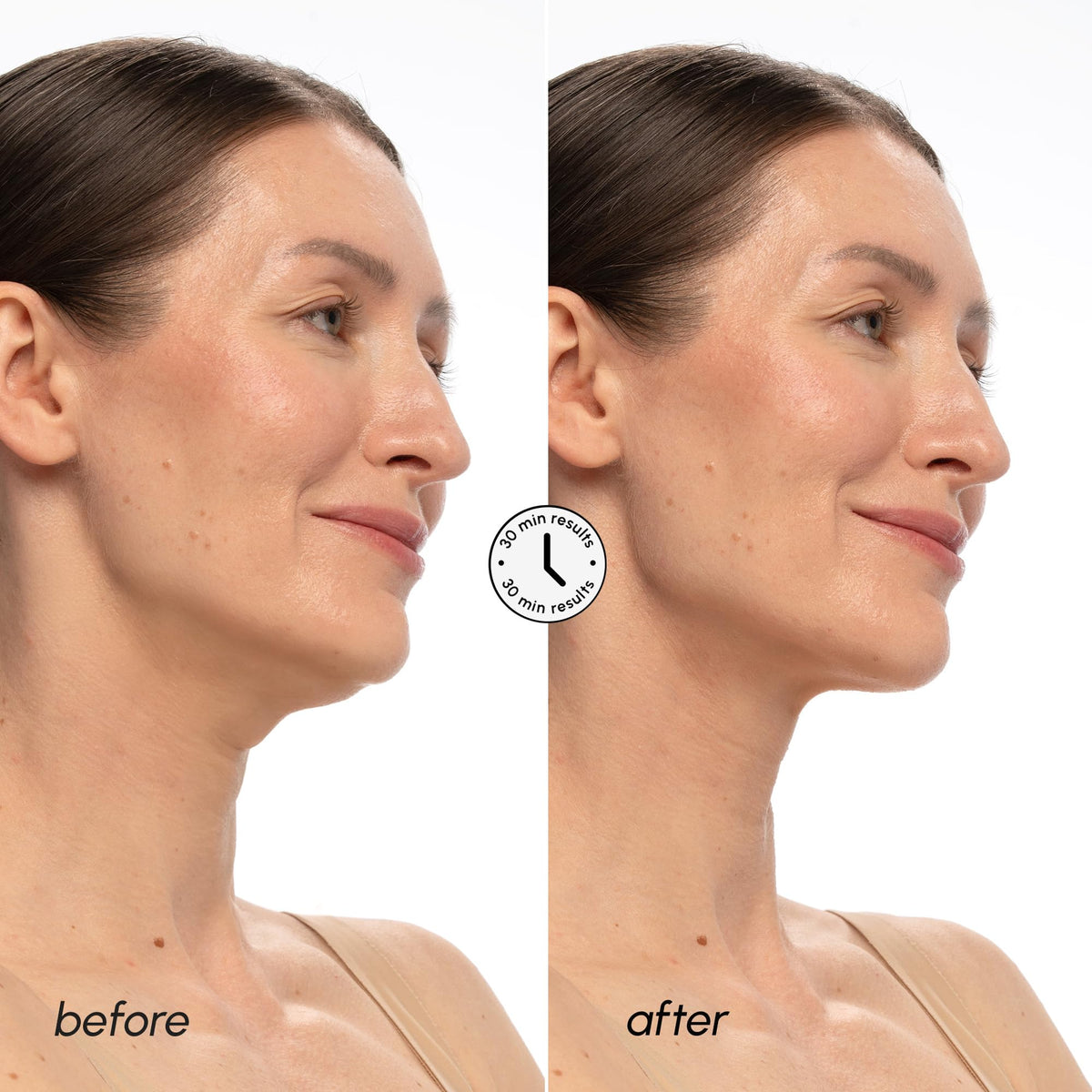Close-up of MAREE V Line Lifting Mask texture