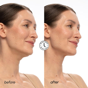 Close-up of MAREE V Line Lifting Mask texture