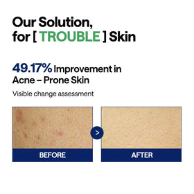 Close-up of MEDIHEAL Toner Pad with tea tree extract
