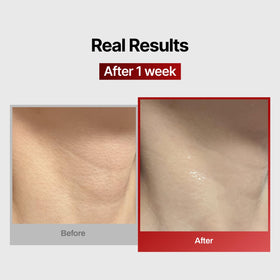 Close-up of MEDITHERAPY Neck Mask texture