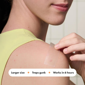Close-up of Mighty Patch Surface hydrocolloid patch on skin