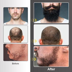 Close-up of Naland Beard Growth Kit packaging